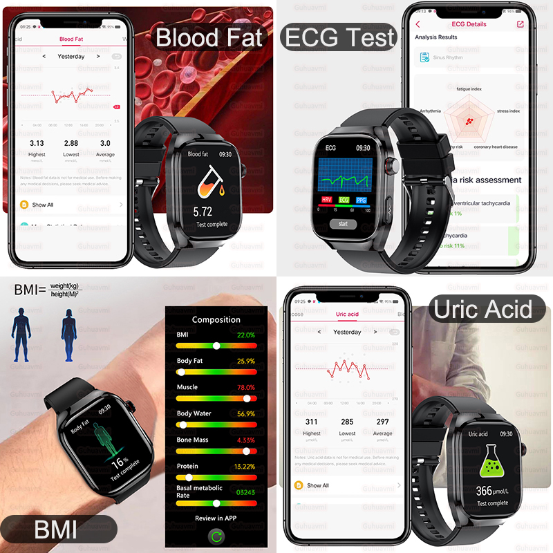 2025년 신형 고정밀 스마트워치 오관검사 ECG 실시 - Smartwatch New Watches 2025 리뷰 및 가격